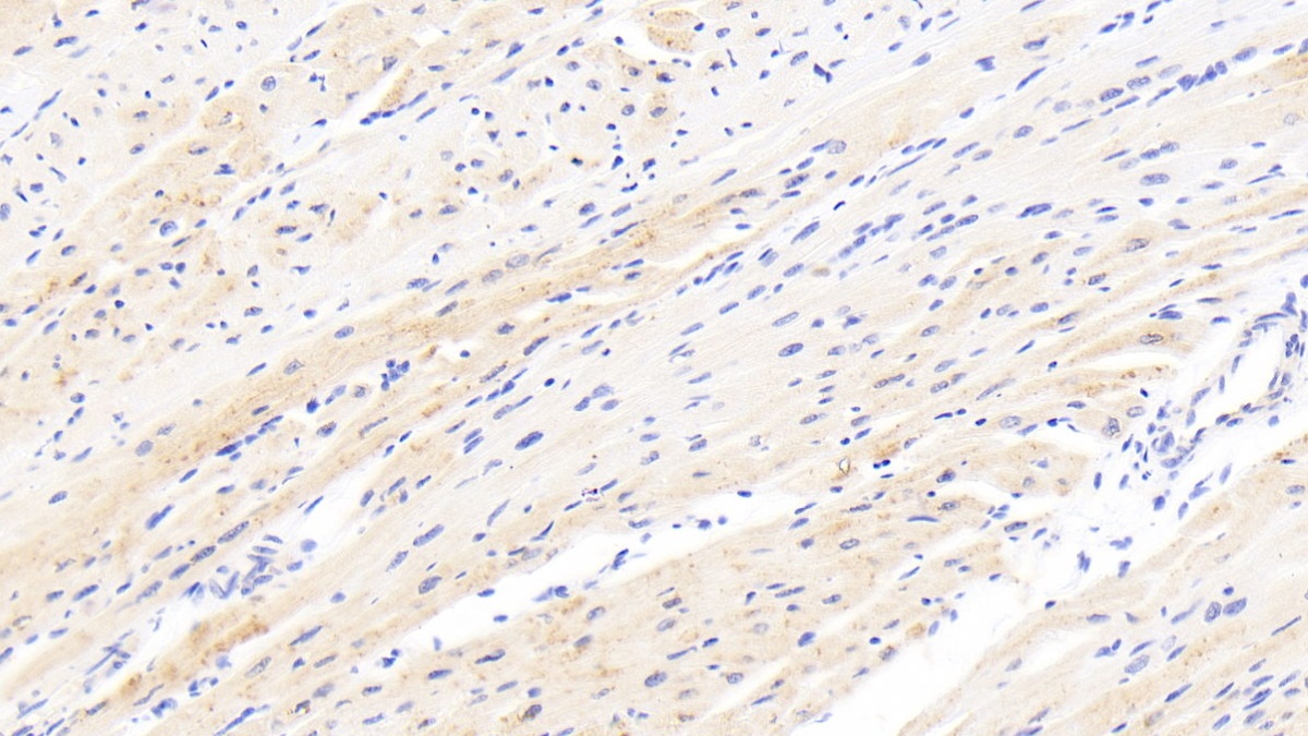 Polyclonal Antibody to Calcium/Calmodulin Dependent Protein Kinase II Beta (CAMK2b)