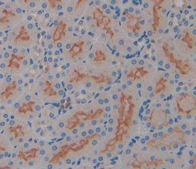 Polyclonal Antibody to Interleukin 17 Receptor D (IL17RD)