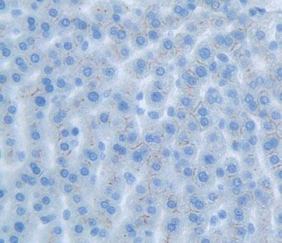 Polyclonal Antibody to Interleukin 17 Receptor B (IL17RB)