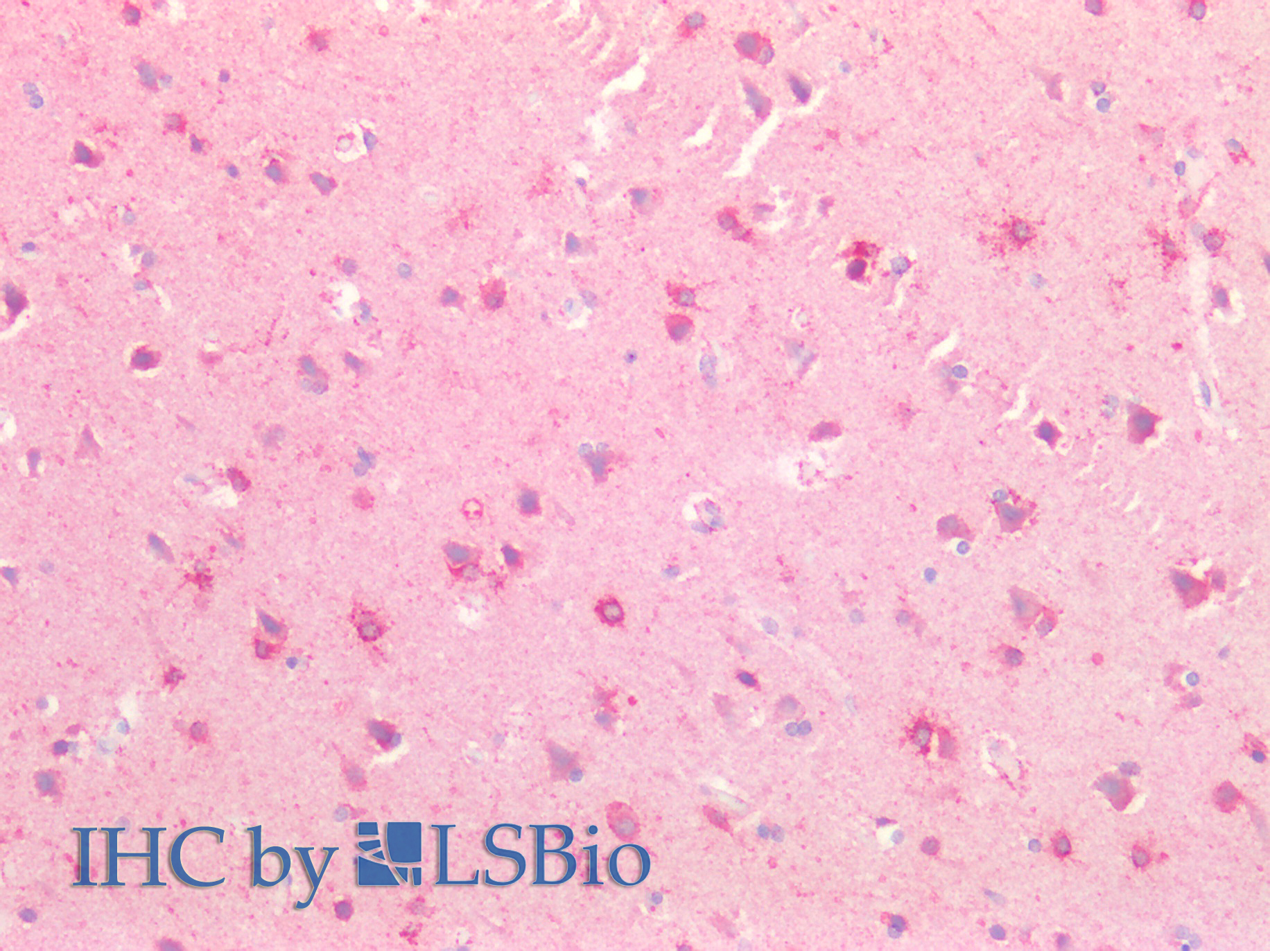 Polyclonal Antibody to Slit Homolog 3 (Slit3)