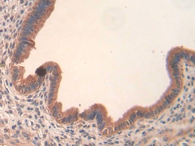 Polyclonal Antibody to Slit Homolog 3 (Slit3)