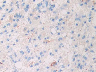 Polyclonal Antibody to Slit Homolog 1 (Slit1)