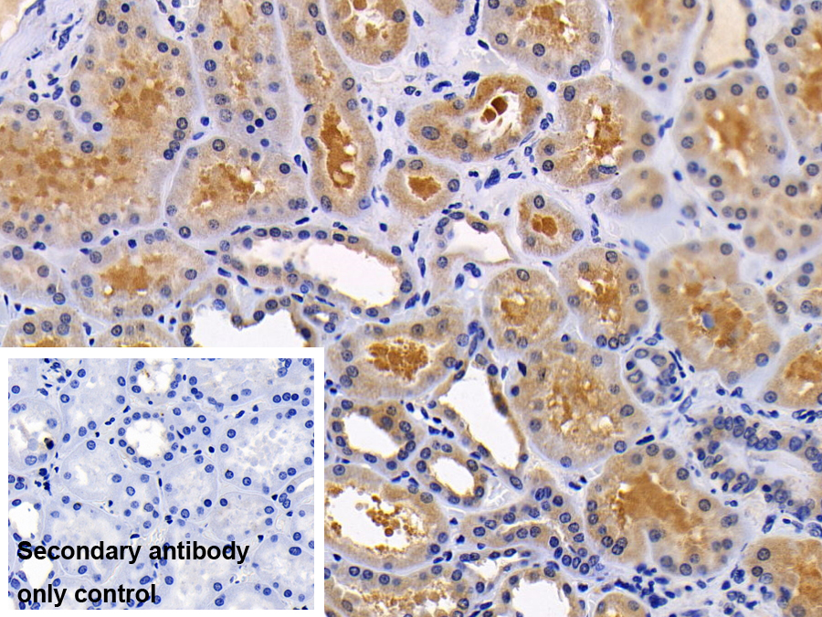 Polyclonal Antibody to Protein Kinase, AMP Activated Alpha 2 (PRKAa2)