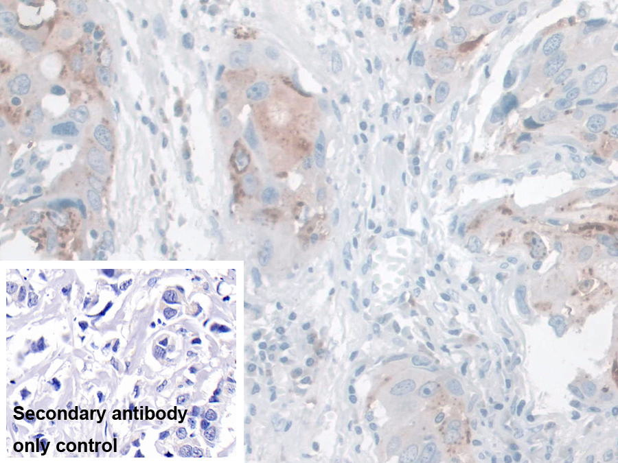 Polyclonal Antibody to Kallikrein 14 (KLK14)