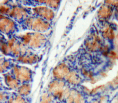 Polyclonal Antibody to Leukocyte Elastase Inhibitor (LEI)