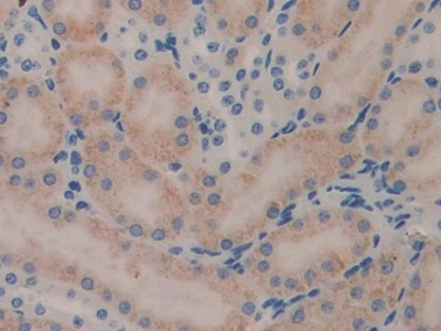 Polyclonal Antibody to Leukocyte Elastase Inhibitor (LEI)