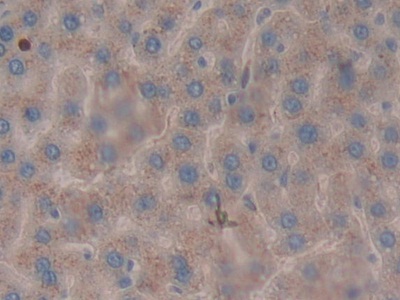 Polyclonal Antibody to Leukocyte Elastase Inhibitor (LEI)