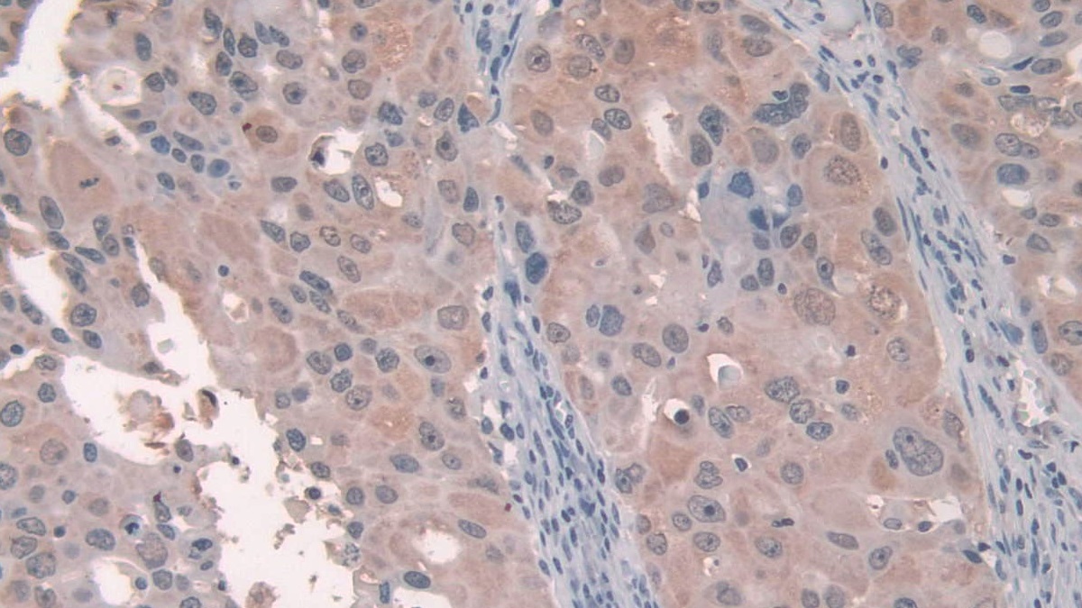 Polyclonal Antibody to Protein C Inhibitor (PCI)