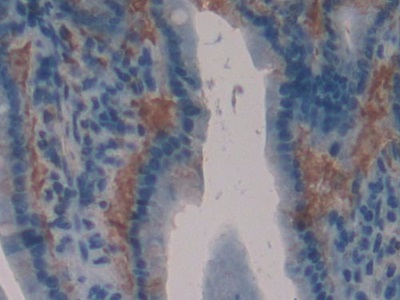 Polyclonal Antibody to Pronociceptin (PNOC)