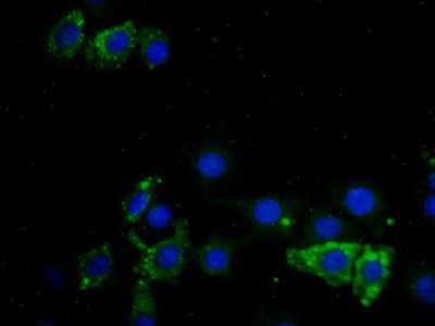 Polyclonal Antibody to Dickkopf Related Protein 3 (DKK3)