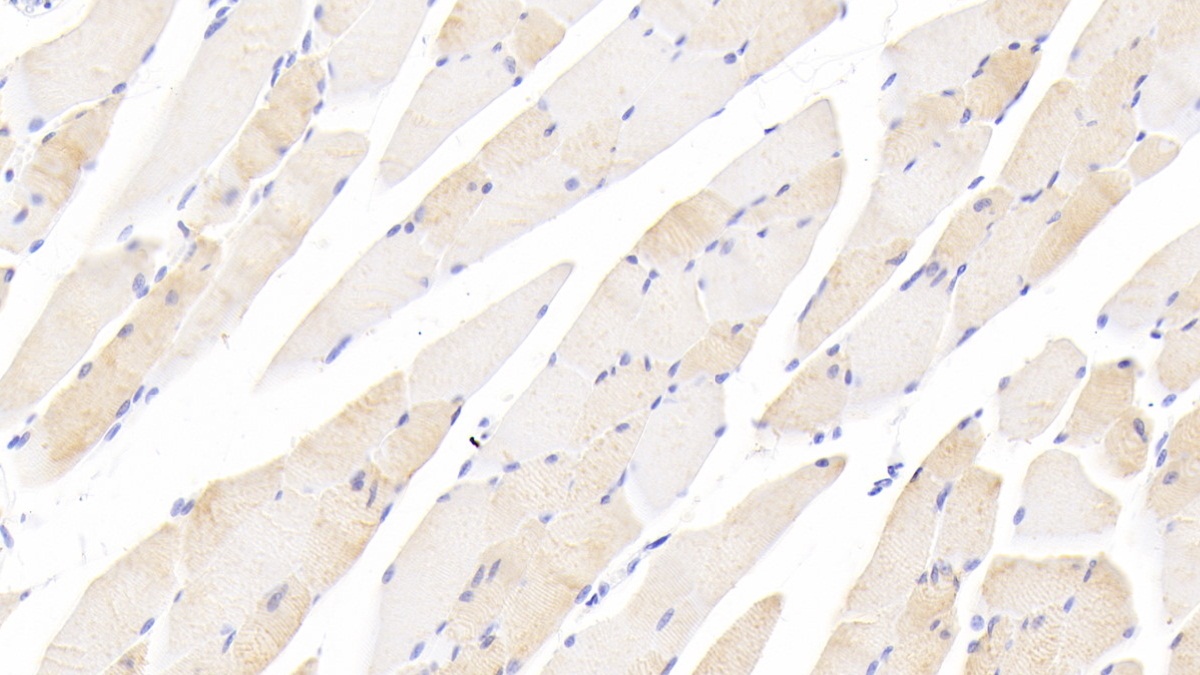 Polyclonal Antibody to Myosin Binding Protein C, Slow Type (MYBPC1)