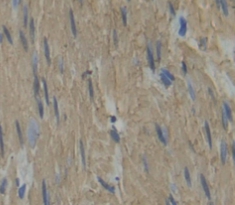 Polyclonal Antibody to Myosin Heavy Chain 3, Skeletal Muscle, Embryonic (MYH3)