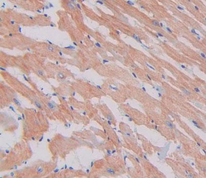 Polyclonal Antibody to Myosin Heavy Chain 3, Skeletal Muscle, Embryonic (MYH3)