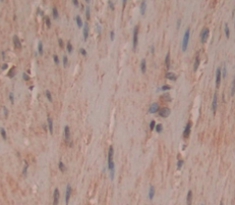 Polyclonal Antibody to Myosin Heavy Chain 4, Skeletal Muscle (MYH4)