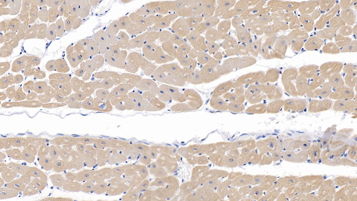 Polyclonal Antibody to Myosin Heavy Chain 7, Cardiac Muscle, Beta (MYH7)