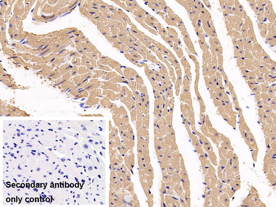 Polyclonal Antibody to Myosin Heavy Chain 6, Cardiac Muscle, Alpha (MYH6)