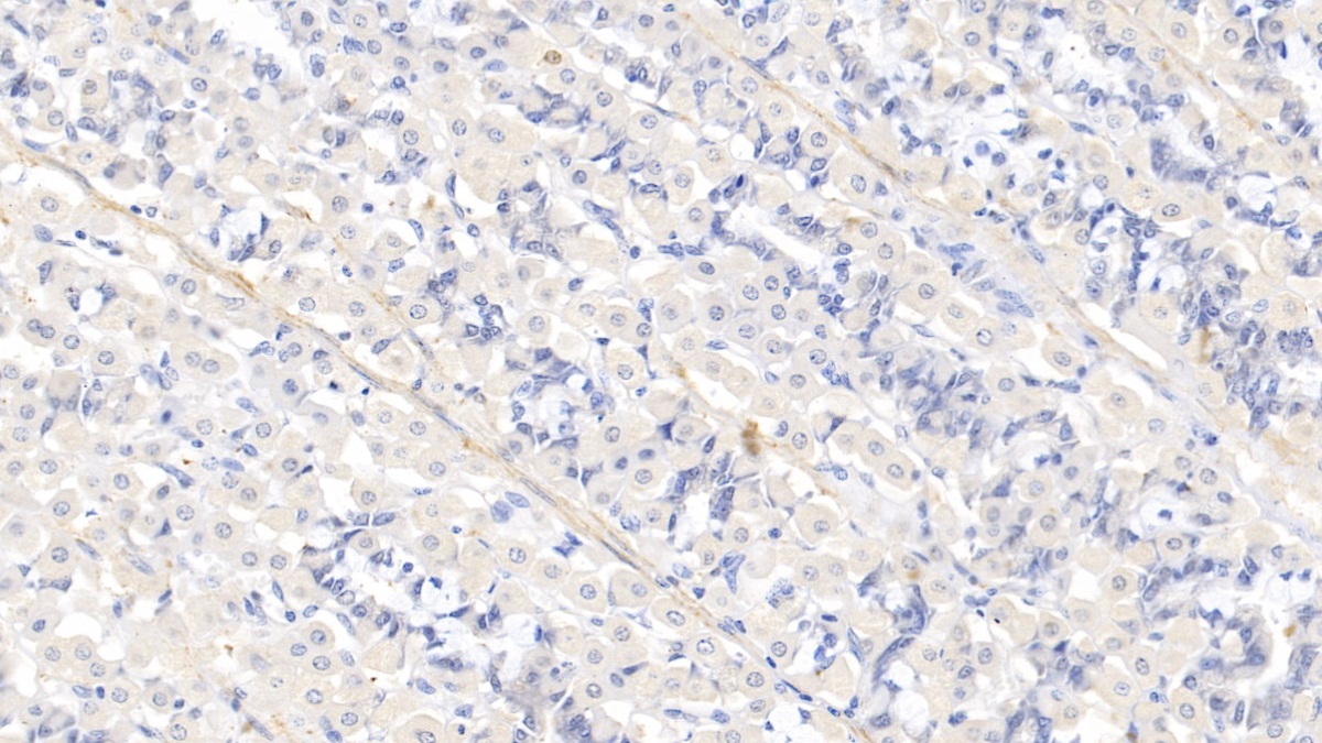 Polyclonal Antibody to Myosin Heavy Chain 11, Smooth Muscle (MYH11)