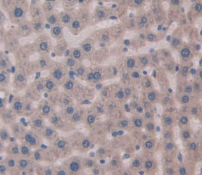 Polyclonal Antibody to Myosin Heavy Chain 8, Skeletal Muscle, Perinatal (MYH8)