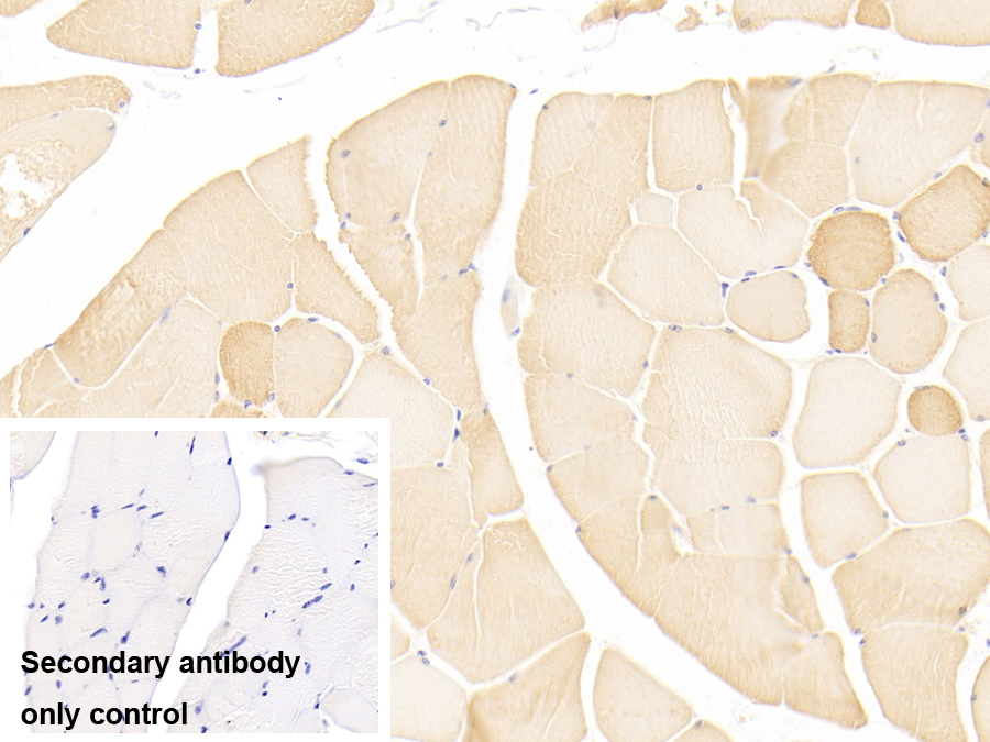 Polyclonal Antibody to Myosin Light Chain 3, Alkali, Ventricular, Slow Skeletal (MYL3)