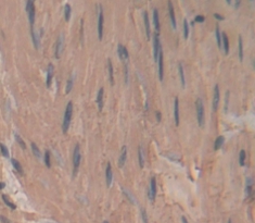 Polyclonal Antibody to Myosin Light Chain 4, Alkali, Atrial, Embryonic (MYL4)