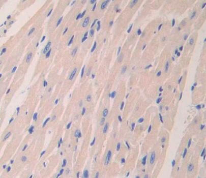 Polyclonal Antibody to Myosin Light Chain Kinase 2 (MYLK2)