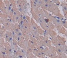 Polyclonal Antibody to Myosin Light Chain Kinase 2 (MYLK2)