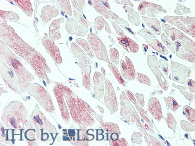 Polyclonal Antibody to Myosin Light Chain Kinase 3 (MYLK3)