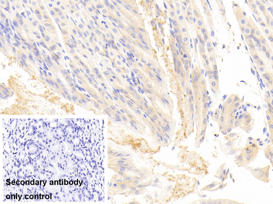 Polyclonal Antibody to Myosin IE (MYO1E)