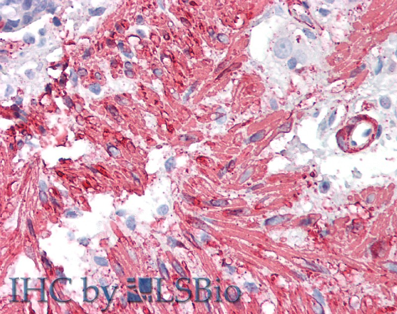 Polyclonal Antibody to Tropomyosin 2 Beta (TPM2)