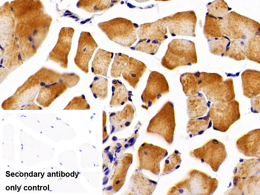 Polyclonal Antibody to Tropomyosin 3 (TPM3)