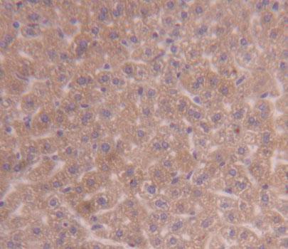 Polyclonal Antibody to Pyruvate Dehydrogenase Kinase Isozyme 3 (PDK3)