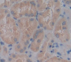 Polyclonal Antibody to Pappalysin 2 (PAPPA2)