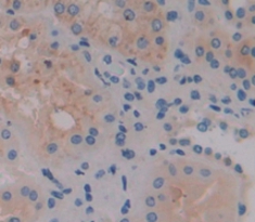 Polyclonal Antibody to Pappalysin 2 (PAPPA2)