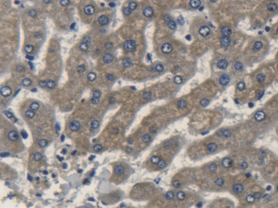 Polyclonal Antibody to Apolipoprotein L2 (APOL2)