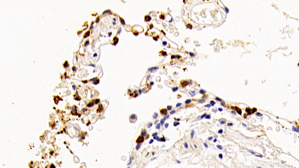 Polyclonal Antibody to Surfactant Associated Protein A2 (SPA2)