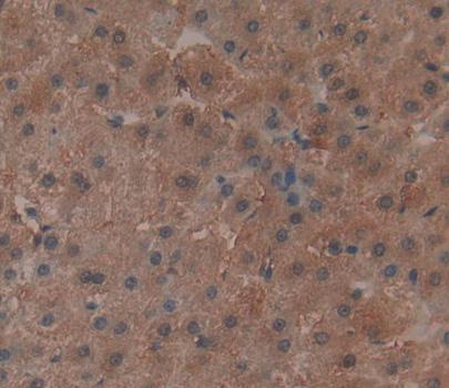 Polyclonal Antibody to Heat Shock Protein 75kDa, Mitochondrial (HSP75)