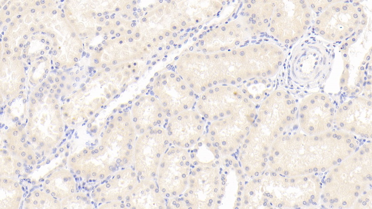 Polyclonal Antibody to Serum Amyloid A4, Constitutive (SAA4)