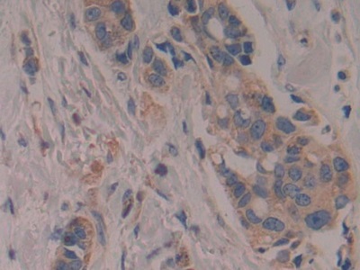 Polyclonal Antibody to Cytochrome P450 27B1 (CYP27B1)