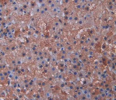 Polyclonal Antibody to Cytochrome P450 11A1 (CYP11A1)