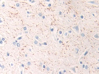 Polyclonal Antibody to Mitogen Activated Protein Kinase Kinase 1 (MAP2K1)