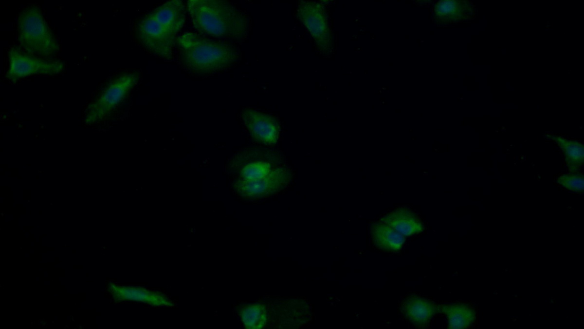 Polyclonal Antibody to Mitogen Activated Protein Kinase Kinase 2 (MAP2K2)