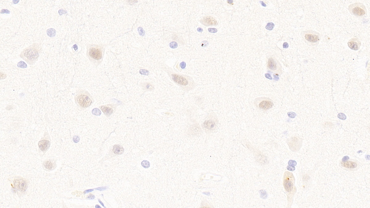 Polyclonal Antibody to Mitogen Activated Protein Kinase Kinase 4 (MAP2K4)