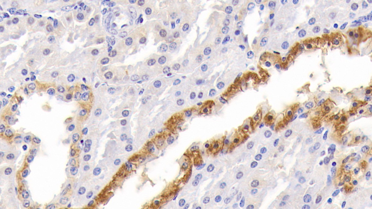 Polyclonal Antibody to Mitogen Activated Protein Kinase Associated Protein 1 (MAPKAP1)