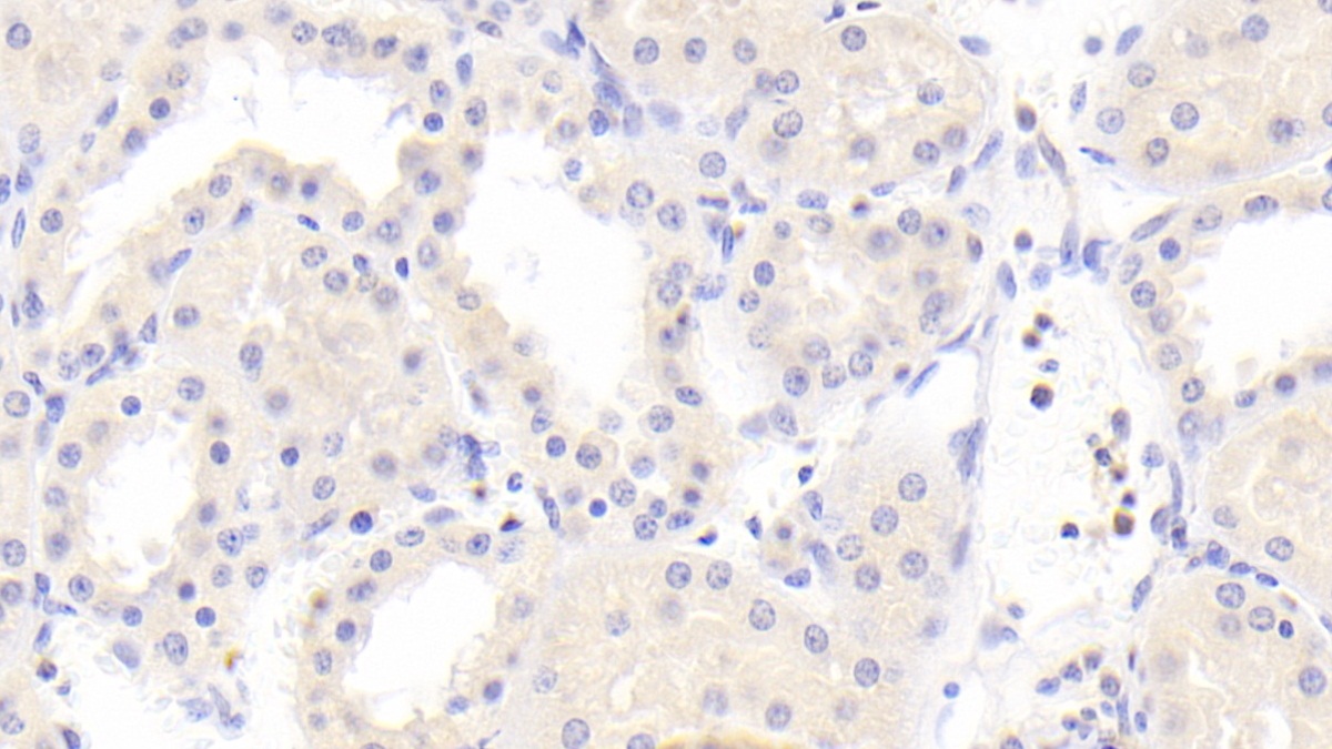 Polyclonal Antibody to Phosphoenolpyruvate Carboxykinase 2, Mitochondrial (PCK2)