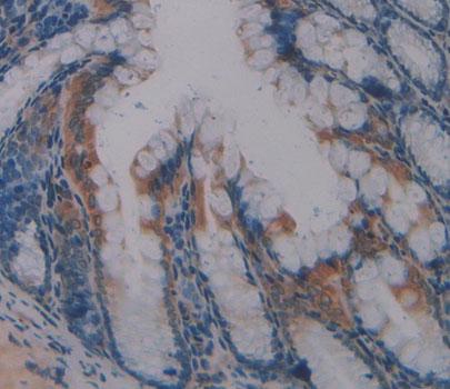 Polyclonal Antibody to Protein Tyrosine Phosphatase, Non Receptor Type 3 (PTPN3)