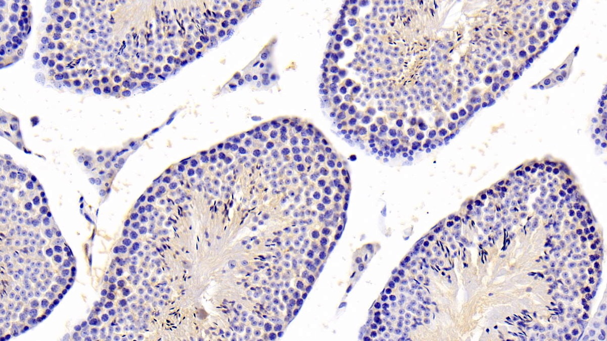 Polyclonal Antibody to Protein Tyrosine Phosphatase, Non Receptor Type 5 (PTPN5)