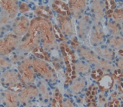 Polyclonal Antibody to Protein Tyrosine Phosphatase, Non Receptor Type 14 (PTPN14)