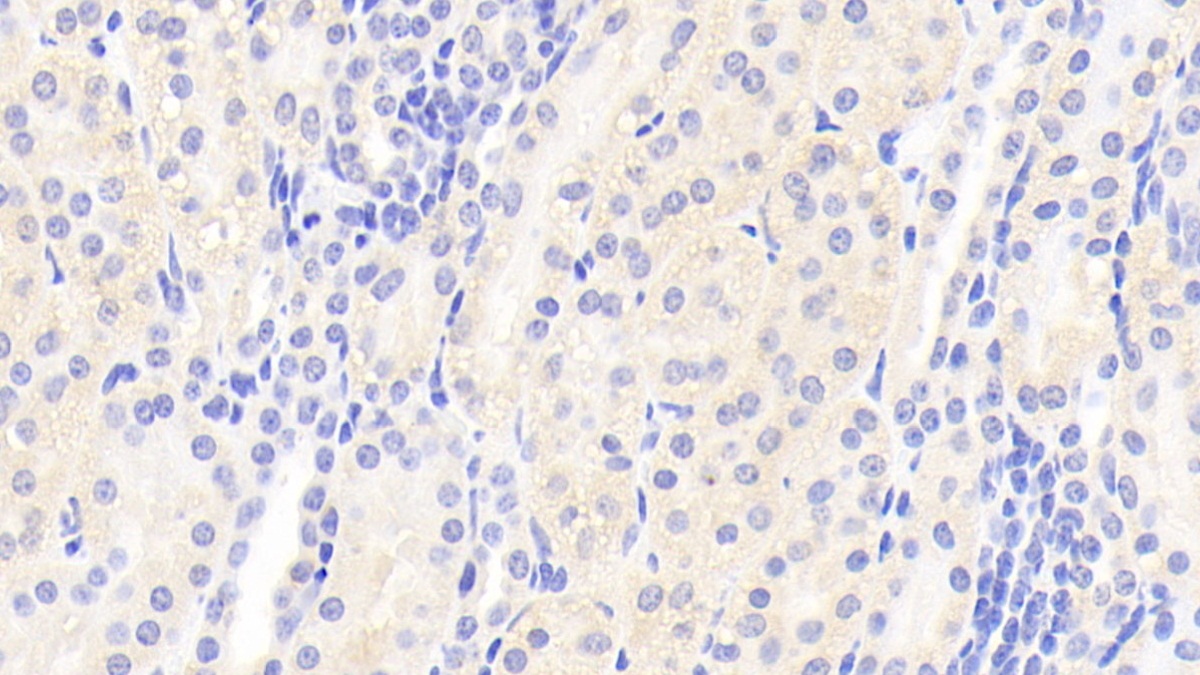 Polyclonal Antibody to Protein Tyrosine Phosphatase, Non Receptor Type 21 (PTPN21)