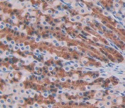 Polyclonal Antibody to Protein Tyrosine Phosphatase, Non Receptor Type 22 (PTPN22)