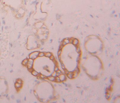 Polyclonal Antibody to Protein Tyrosine Phosphatase Receptor Type G (PTPRG)